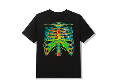 Anti Social Social Club Blow To The Chest T-shirt Black